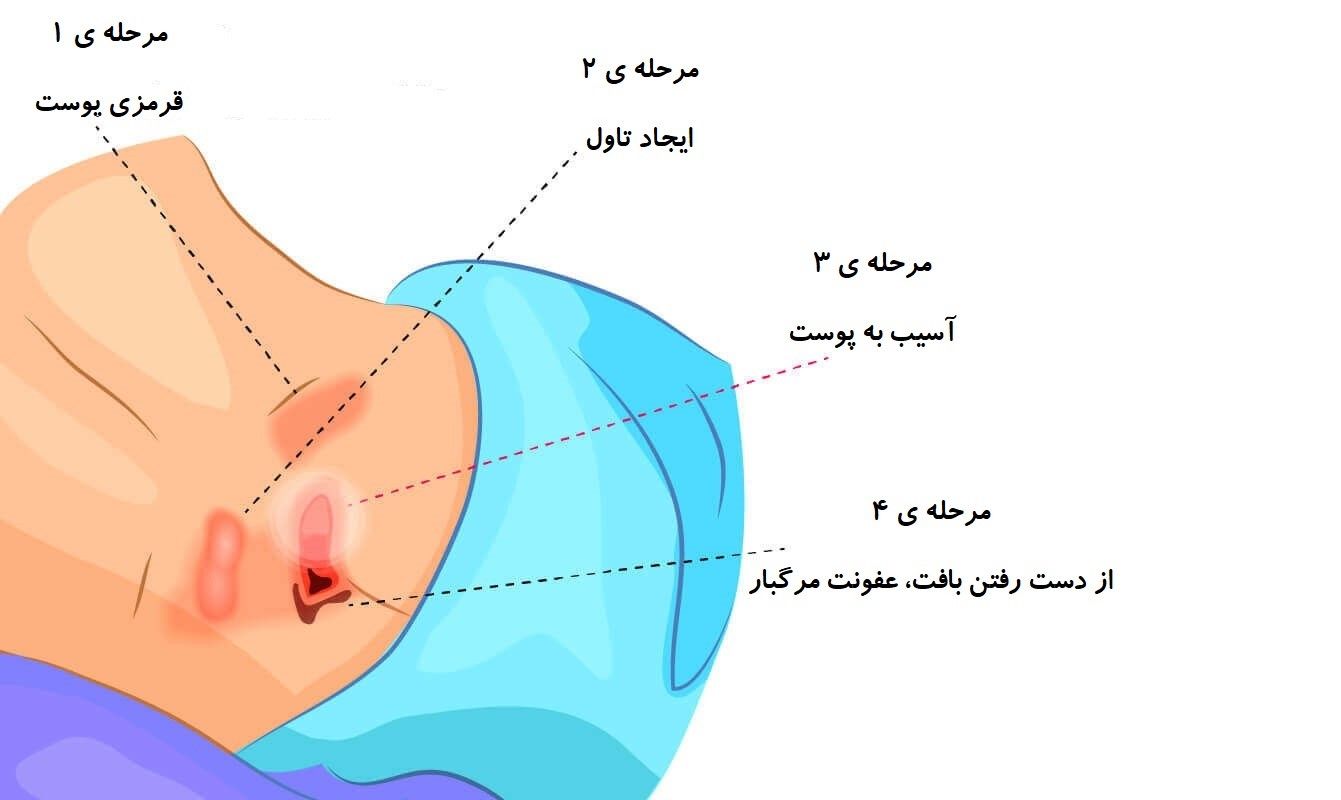 تغذیه |دیابت