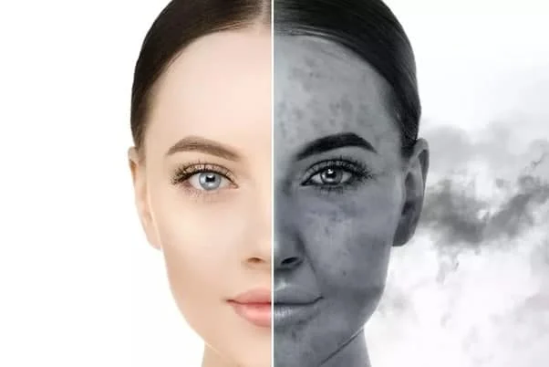 تاثیر آلودگی هوا بر کک و مک صورت و راه‌های مقابله با آن