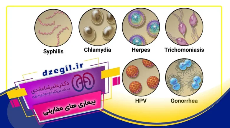 از کجا بفهمم بیماری مقاربتی دارم؟