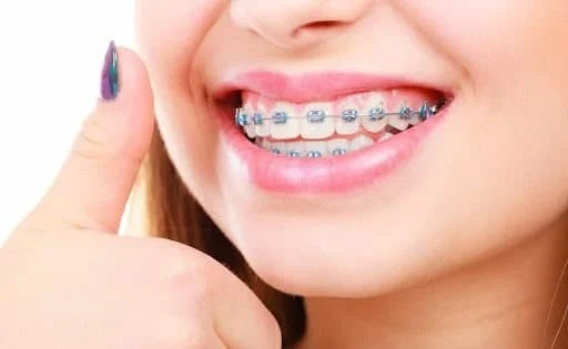 آیا ارتودنسی صدا را تغییر میدهد