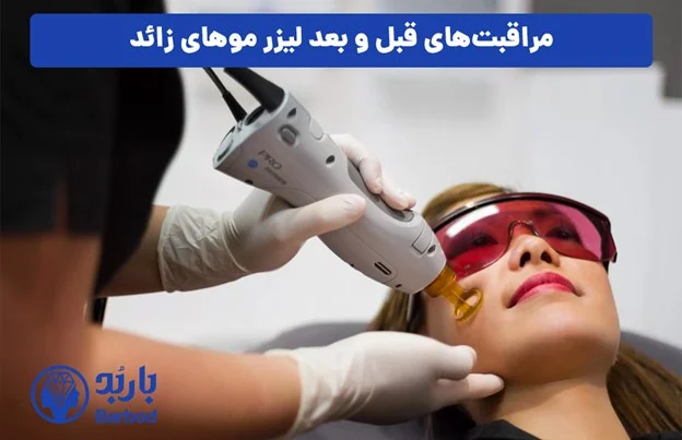 میزان تاثیر لیزر در از بین بردن موهای زائد