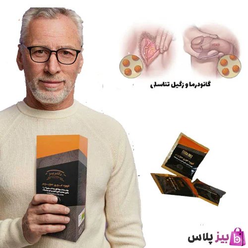 از کجا بفهمم زگیل دارم؟