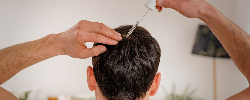 Minoxidil and the experience of using it for hair loss