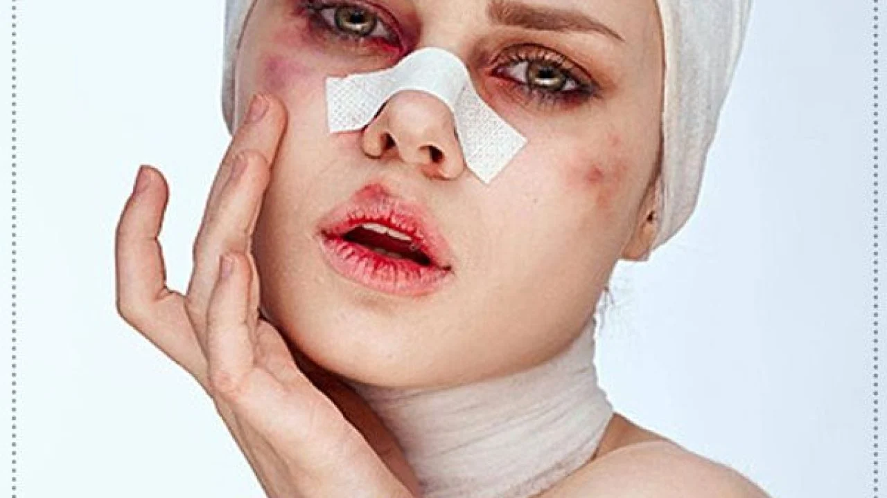 You should not go to the pool until after the nose job
