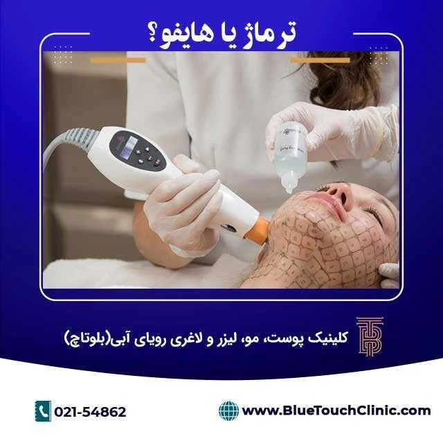 اندولیفت بهتره یا ترماژ؟