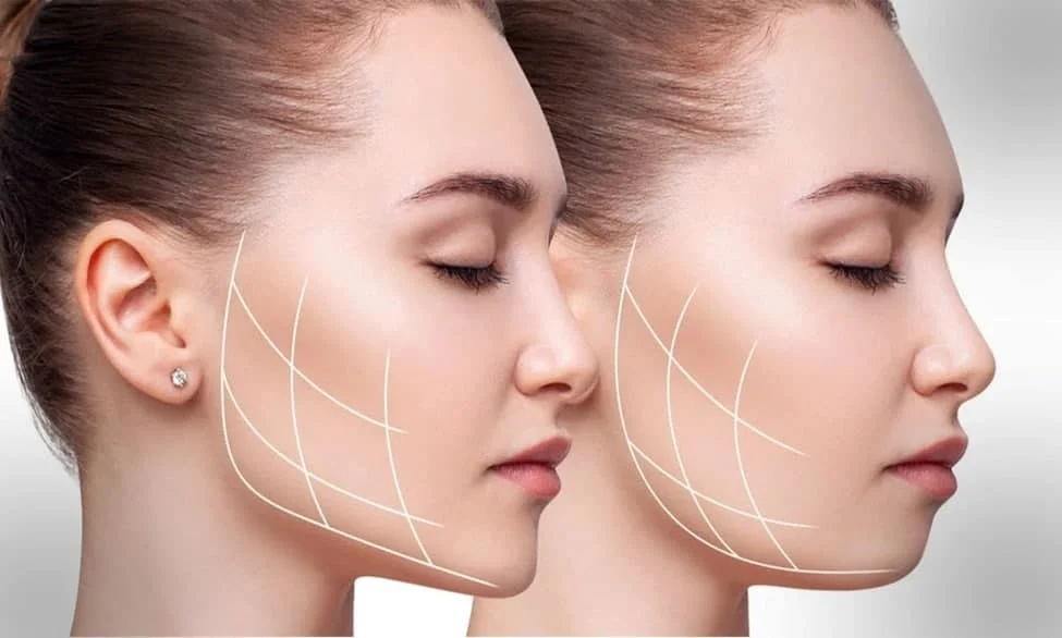 بوکال فت چیست؟ آیا بوکال فت باعث پیری صورت می‌شود؟
