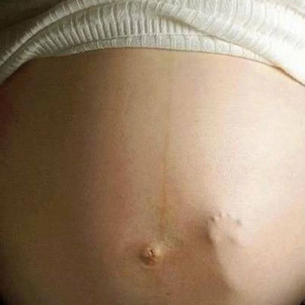 چگونه از طریق لگد زدن جنین، جنسیت آن را تشخیص دهیم؟ چگونه از طریق لگد زدن جنین، جنسیت آن را تشخیص دهیم؟