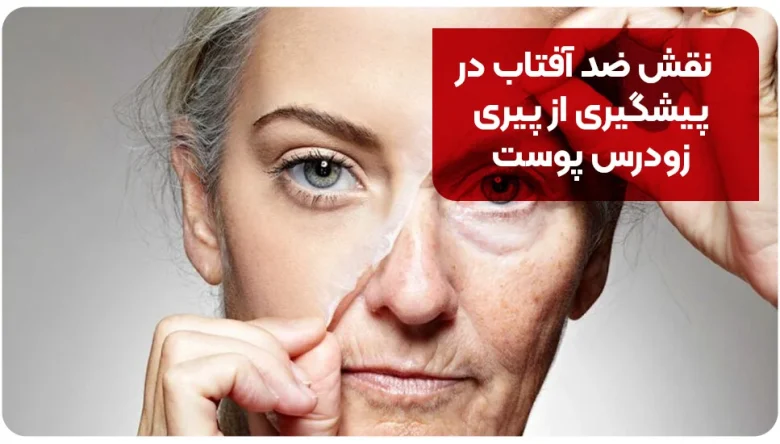 نقش ضد آفتاب در پیشگیری از پیری زودرس پوست