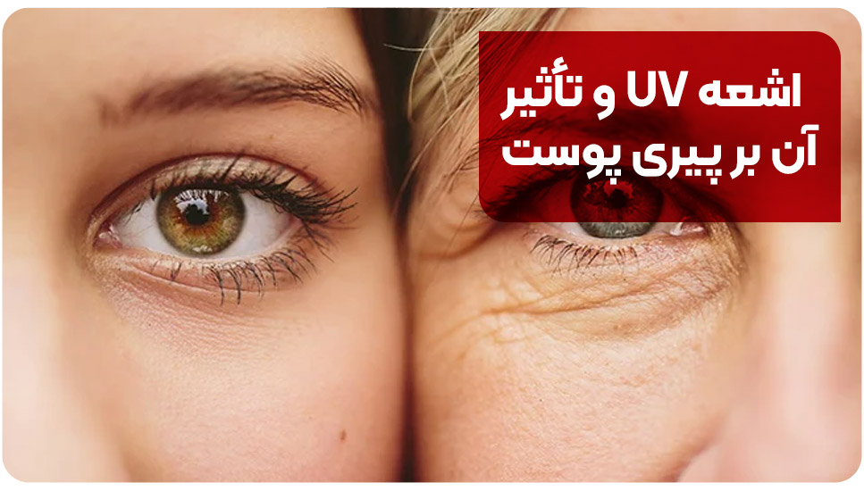 اشعه UV و تأثیر آن بر پیری پوست