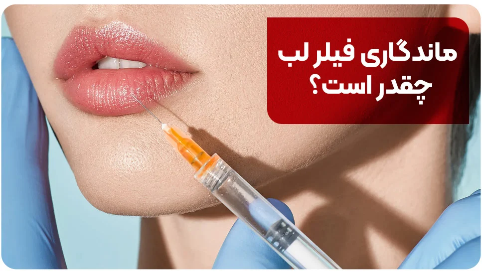 ماندگاری فیلر لب چقدر است؟