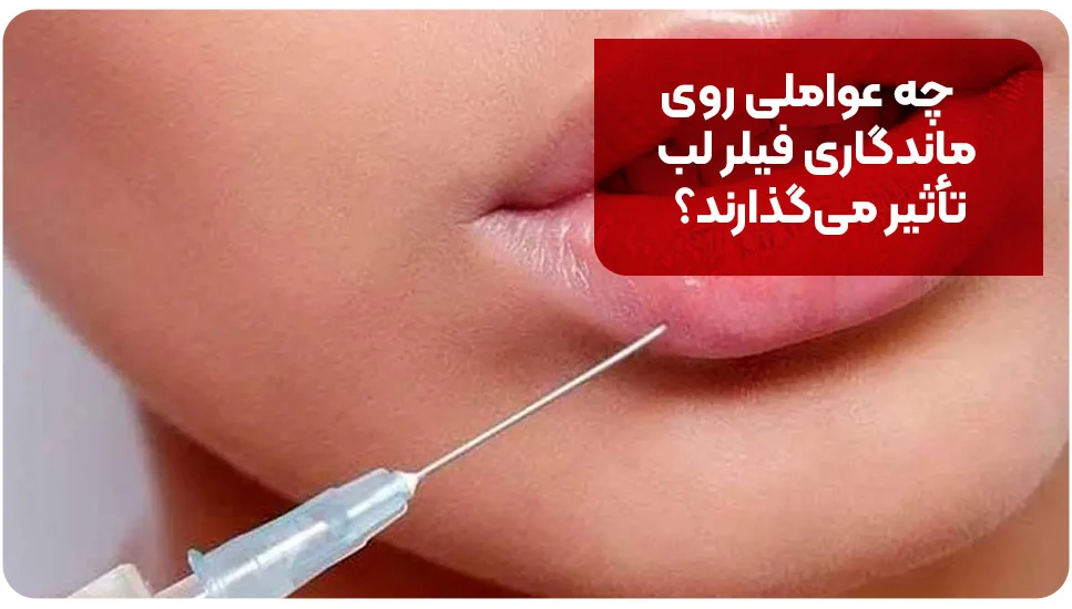 ماندگاری فیلر لب چقدر است؟ چه عواملی روی ماندگاری فیلر لب تأثیر میگذارند؟