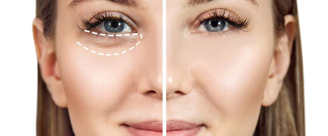 تجربه کاربران و نتایج واقعی استفاده از ژل کرم نوویتا ۴+ سیلکر