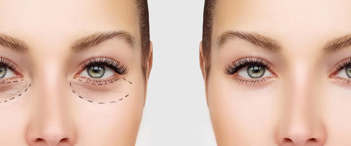 توصیه‌های پزشکان و متخصصان پوست